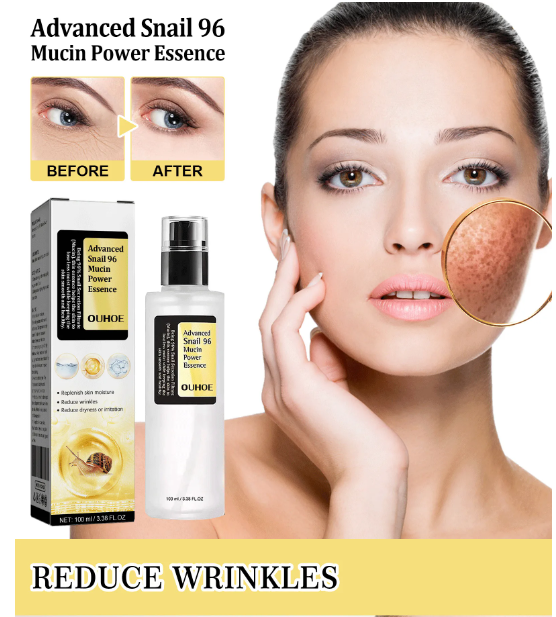 Skincare product with packaging and before/after effects on skin, featuring a woman's face.