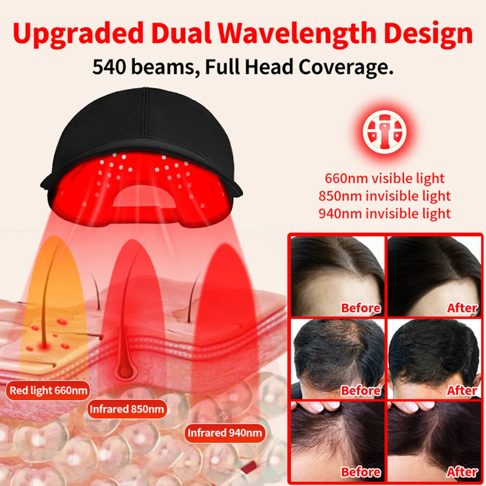 Hair growth device with dual wavelength design and before-and-after results.